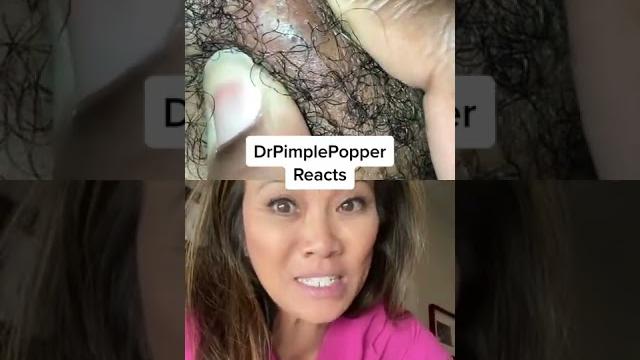 Dr pimple popper needs a splash screen! #dppreacts Dr pimple popper needs a splash screen! #dppreacts