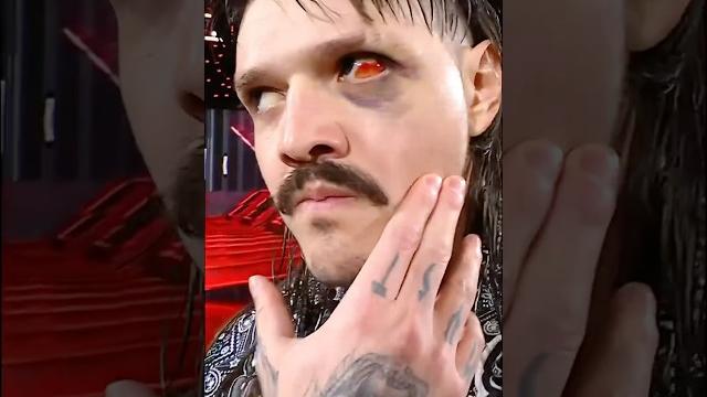 Just throw the whole eye away at this point ️ #wweraw Just throw the whole eye away at this point ️ #wweraw