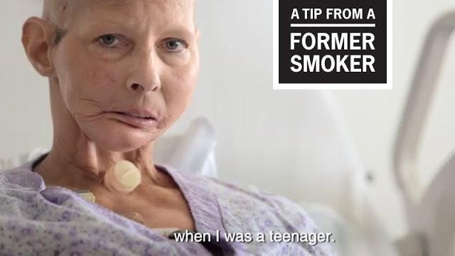Cdc: tips from former smokers - terrie h.: teenager ad Cdc: tips from former smokers - terrie h.: teenager ad