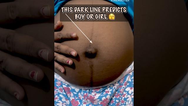 Pregnancy dark line on belly ii linea nigra ii #viral #shorts #youtubeshorts #pregnancy Pregnancy dark line on belly ii linea nigra ii #viral #shorts #youtubeshorts #pregnancy