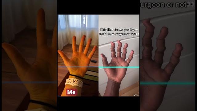 Real doctor tries viral tiktok surgeon challenge Real doctor tries viral tiktok surgeon challenge