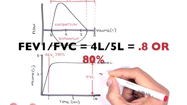 Understanding spirometry - normal, obstructive vs restrictive Understanding spirometry - normal, obstructive vs restrictive