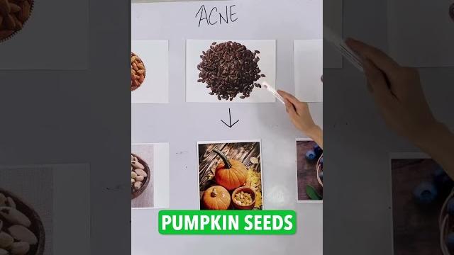 Food tips for acne. || dr.sarin || Food tips for acne. || dr.sarin ||