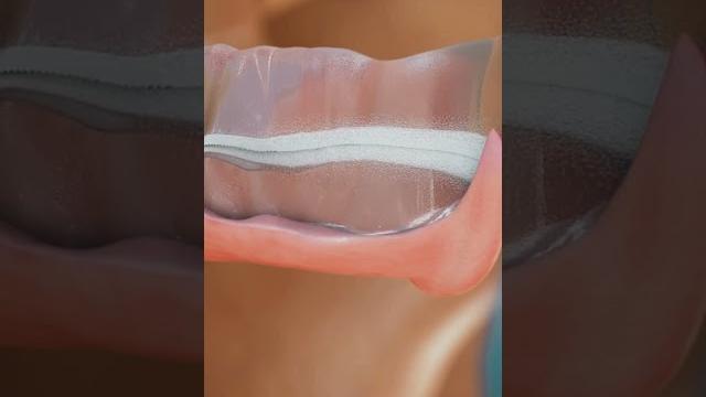 How to remove your iud? #4k #animation #asmr How to remove your iud? #4k #animation #asmr