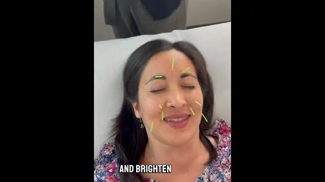 Acu-facial treatment with yina skin care & celluma light therapy! #skincare #acupuncture #yina Acu-facial treatment with yina skin care & celluma light therapy! #skincare #acupuncture #yina