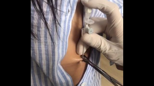 Naz mila göbeğine piercng yaptırıyor Naz mila göbeğine piercng yaptırıyor
