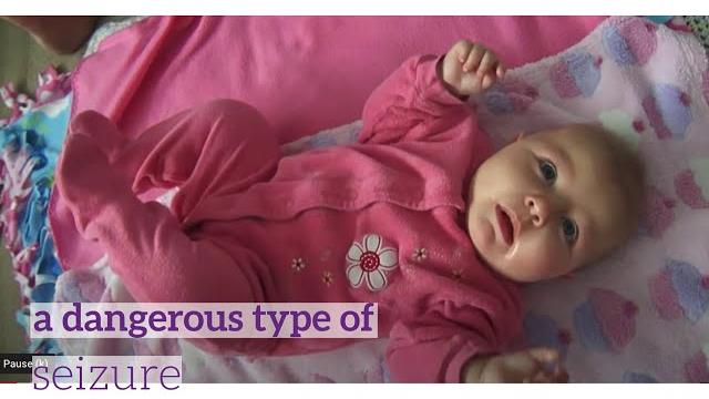 Signs of infantile spasms Signs of infantile spasms