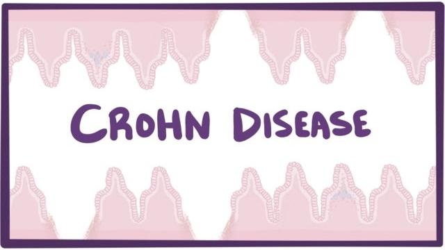 Crohn's disease (crohn disease) - causes, symptoms & pathology Crohn's disease (crohn disease) - causes, symptoms & pathology