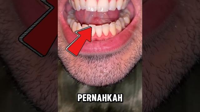 Lidah mengeluarkan air aneh‼️ Lidah mengeluarkan air aneh‼️
