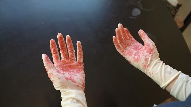 Sterile gloves video Sterile gloves video