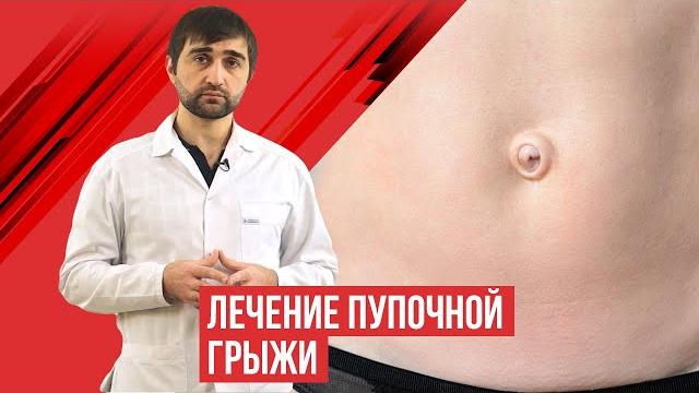 Пупочная грыжа. лечение. Пупочная грыжа. лечение.