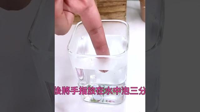 手指扎刺了 手指扎刺了