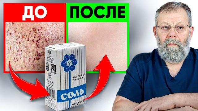 Соль и вода — секрет упругой кожи и здоровой желчи Соль и вода — секрет упругой кожи и здоровой желчи