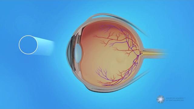Peripheral vision and central vision in the retina Peripheral vision and central vision in the retina