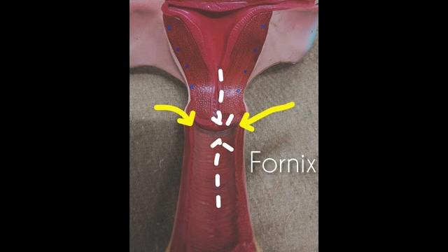 Anatomy of uterus -simplified Anatomy of uterus -simplified