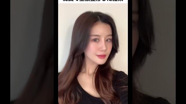 韓国で全顔整形した結果… 韓国で全顔整形した結果…