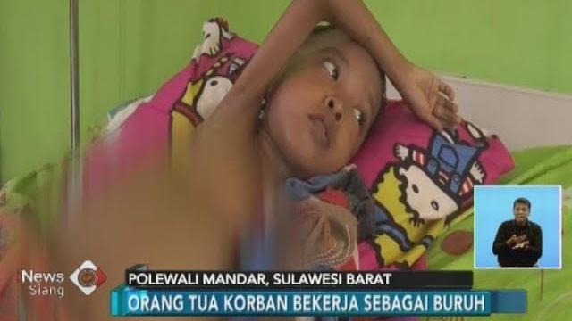 Memprihatinkan!! bocah berusia 9 tahun di polewali mandar mengalami malnutrisi - inews siang 09/07 Memprihatinkan!! bocah berusia 9 tahun di polewali mandar mengalami malnutrisi - inews siang 09/07