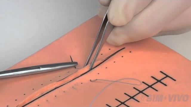 Sim suture - 4. the instrument tie Sim suture - 4. the instrument tie