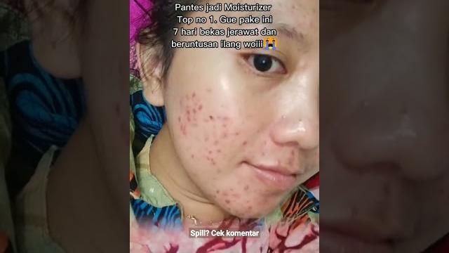 Pantes jadi moisturizer no 1 hasilnya kek gini Pantes jadi moisturizer no 1 hasilnya kek gini