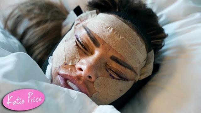 Katie price: face surgery part 2 (explicit) Katie price: face surgery part 2 (explicit)