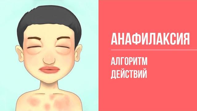 Неотложная помощь: анафилактический шок Неотложная помощь: анафилактический шок