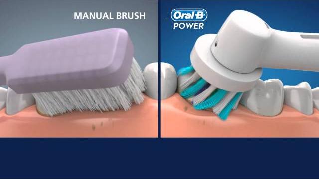Oral-b crossaction vs manual toothbrush Oral-b crossaction vs manual toothbrush