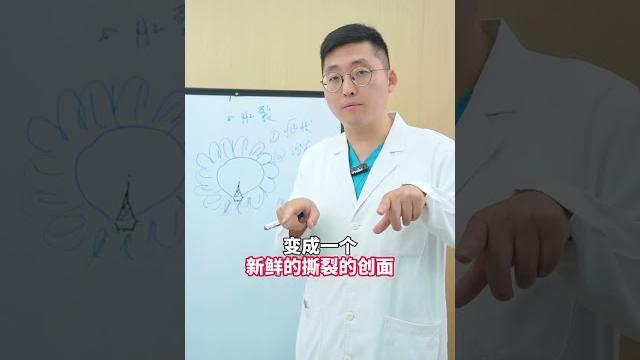扩肛这件事儿真没想象中那么简单#肛肠科 #医学科普 扩肛这件事儿真没想象中那么简单#肛肠科 #医学科普