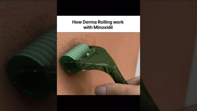 How derma rolling work with minoxidil ️ #shorts #hair #haircare #usa #uk #unitedstates #fyp How derma rolling work with minoxidil ️ #shorts #hair #haircare #usa #uk #unitedstates #fyp