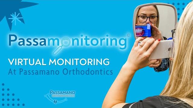 Passamonitoring explained! remote orthodontics! | orthodontist for teens and adults | irvine, ca Passamonitoring explained! remote orthodontics! | orthodontist for teens and adults | irvine, ca