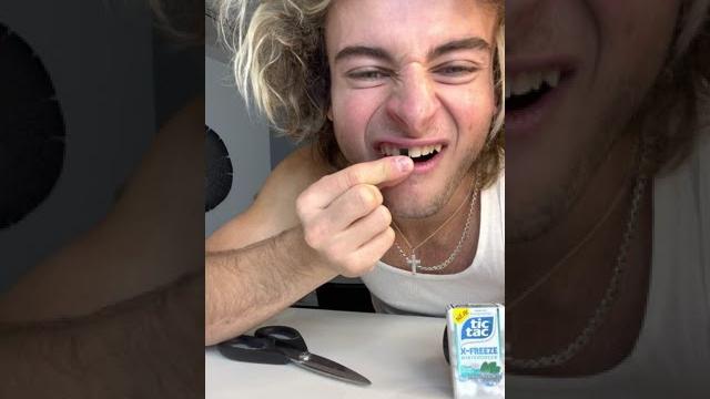 Topper guild loses tooth prank - #shorts Topper guild loses tooth prank - #shorts