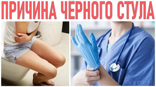 Черный стул | что делать если черный стул Черный стул | что делать если черный стул