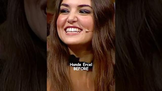 Hande lost 30 kg before or after ? #handeerçel Hande lost 30 kg before or after ? #handeerçel