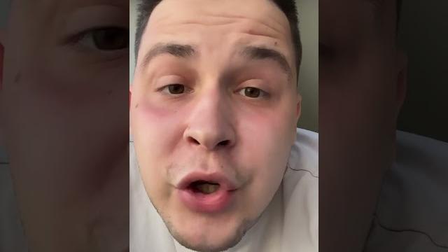 Про роды путем кесарева сечения Про роды путем кесарева сечения