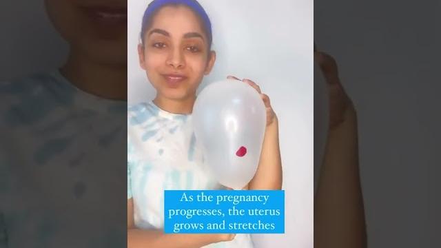 How low lying placenta resolves itself during pregnancy How low lying placenta resolves itself during pregnancy