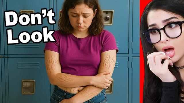 Girl gets bullied for having stretch marks Girl gets bullied for having stretch marks