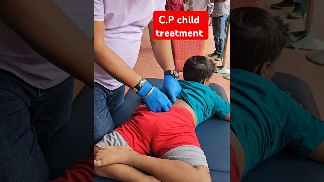 C.p child treatment #drrajneeshkant #worldfamouschiropractor C.p child treatment #drrajneeshkant #worldfamouschiropractor