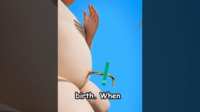 What causes an outie belly button? What causes an outie belly button?