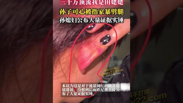 抖音三千万粉丝顶流网红田姥姥孙子被指家暴 911w粉丝孙媳妇欧尼熊公布大量证据引发热议 #田姥姥 #田姥姥孙子可心家暴 #欧尼熊 #吃瓜 #熱門 #大熱門 #新闻 #分享 #黑料 #news 抖音三千万粉丝顶流网红田姥姥孙子被指家暴 911w粉丝孙媳妇欧尼熊公布大量证据引发热议 #田姥姥 #田姥姥孙子可心家暴 #欧尼熊 #吃瓜 #熱門 #大熱門 #新闻 #分享 #黑料 #news