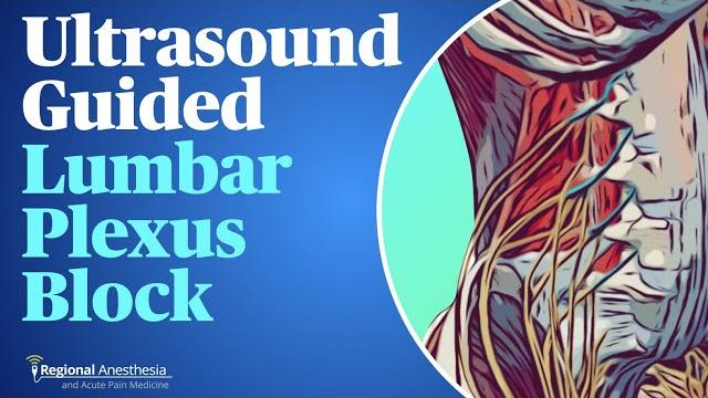 Ultrasound-guided lumbar plexus block Ultrasound-guided lumbar plexus block