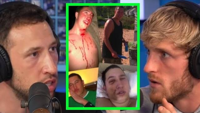 Mike describes most gruesome injuries ever endured Mike describes most gruesome injuries ever endured