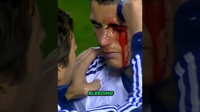 When ronaldo loses his control When ronaldo loses his control
