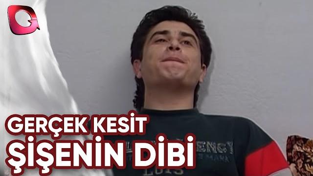 Gerçek kesit | şişenin dibi Gerçek kesit | şişenin dibi