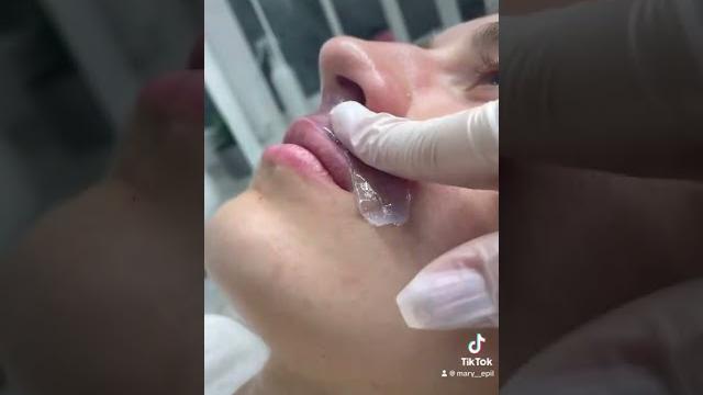 Депиляция верхней губы тонким воском Депиляция верхней губы тонким воском