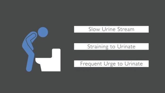 Trouble urinating? what causes urinary issues in men Trouble urinating? what causes urinary issues in men