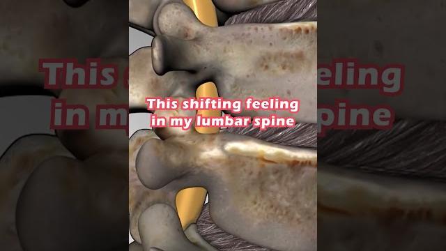 Chiropractic adjustment gone wrong Chiropractic adjustment gone wrong