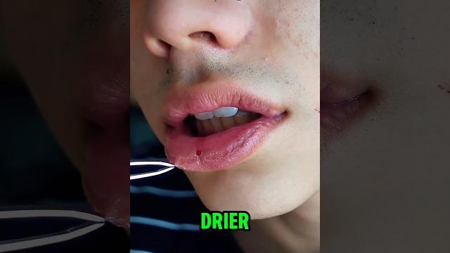 This is how to treat dry lips‼️#shorts #viralvideo This is how to treat dry lips‼️#shorts #viralvideo