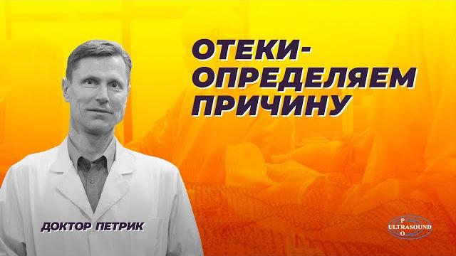 Отеки. определяем причины Отеки. определяем причины