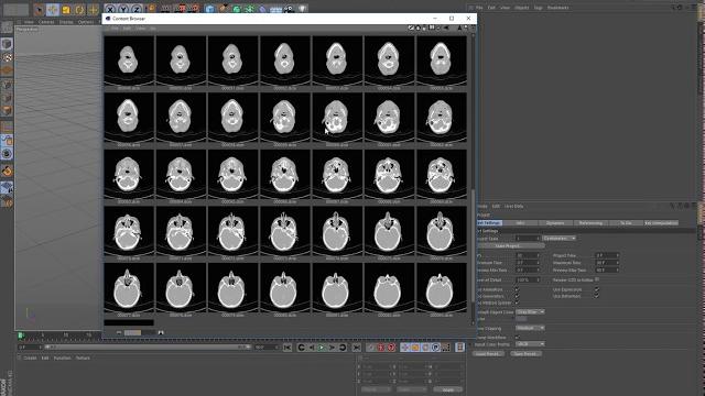 Dicom importer plugins for cinema 4d Dicom importer plugins for cinema 4d