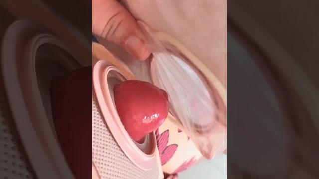 Camisinha na bolsa de ostomia Camisinha na bolsa de ostomia