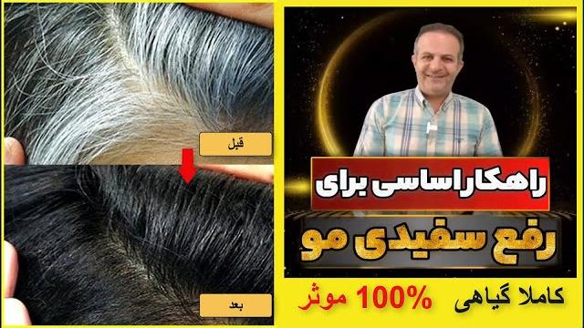 راهکار اساسی برای رفع سفیدی مو کاملا علمی گیاهی 100% موثر - the basic solution to remove white hair راهکار اساسی برای رفع سفیدی مو کاملا علمی گیاهی 100% موثر - the basic solution to remove white hair